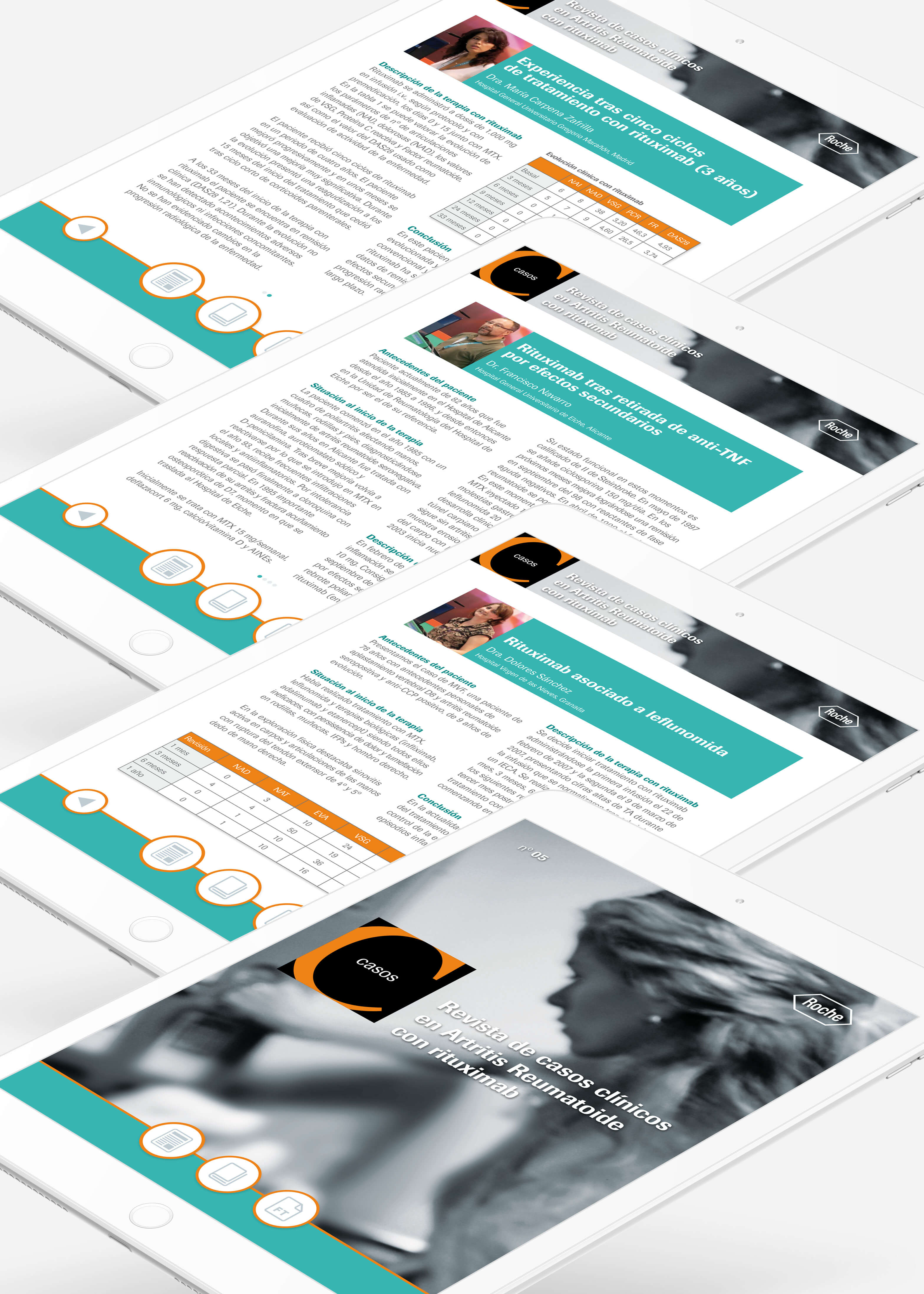 Revista Casos en Artritis Reumatoide